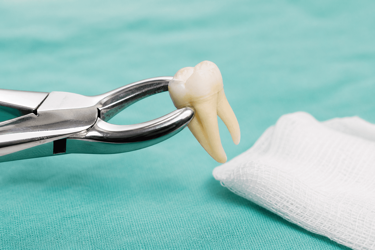 Extração de dente — tratamento odontológico na Base Odontologia
