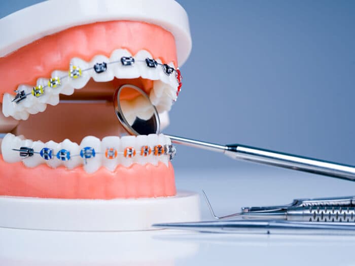 Tratamentos ortodônticos — tratamento odontológico na Base Odontologia